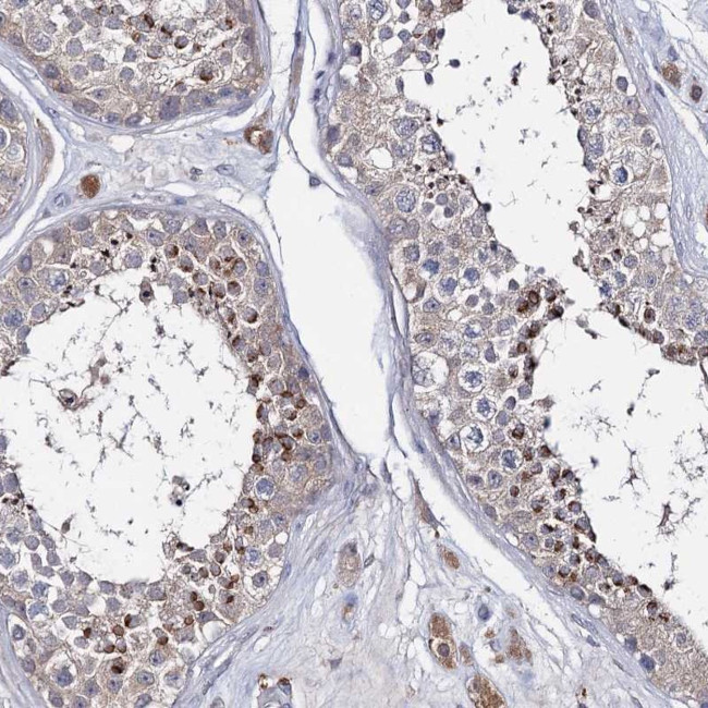 LYZL4 Antibody in Immunohistochemistry (Paraffin) (IHC (P))