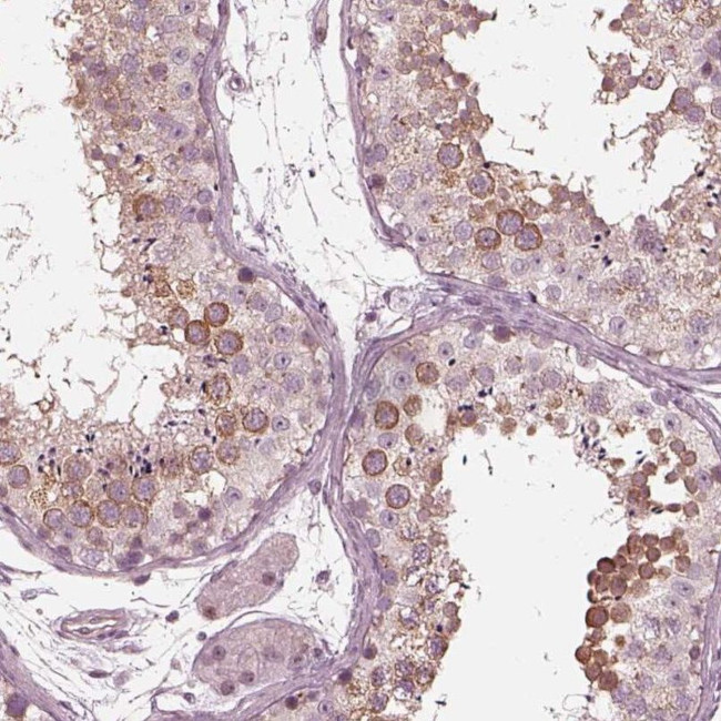 KIF6 Antibody in Immunohistochemistry (IHC)