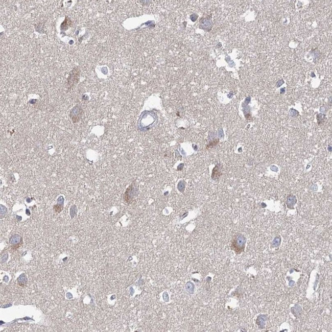 RICH2 Antibody in Immunohistochemistry (IHC)