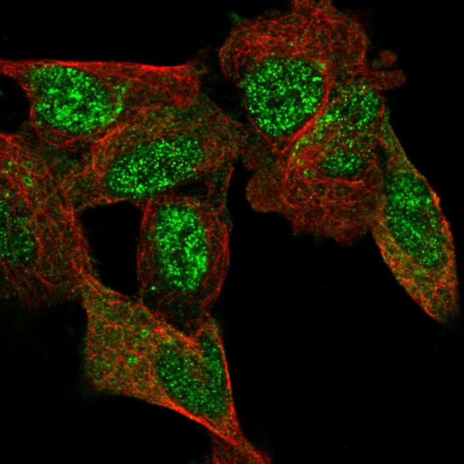 C11orf96 Antibody in Immunocytochemistry (ICC/IF)