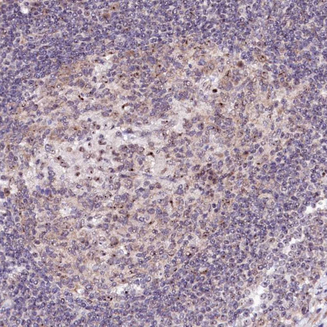 RBM19 Antibody in Immunohistochemistry (Paraffin) (IHC (P))