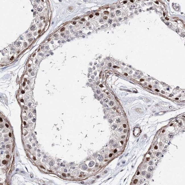 TTC40 Antibody in Immunohistochemistry (IHC)