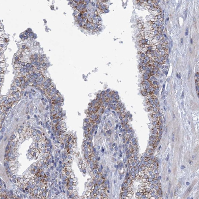 NDUFC2 Antibody in Immunohistochemistry (Paraffin) (IHC (P))