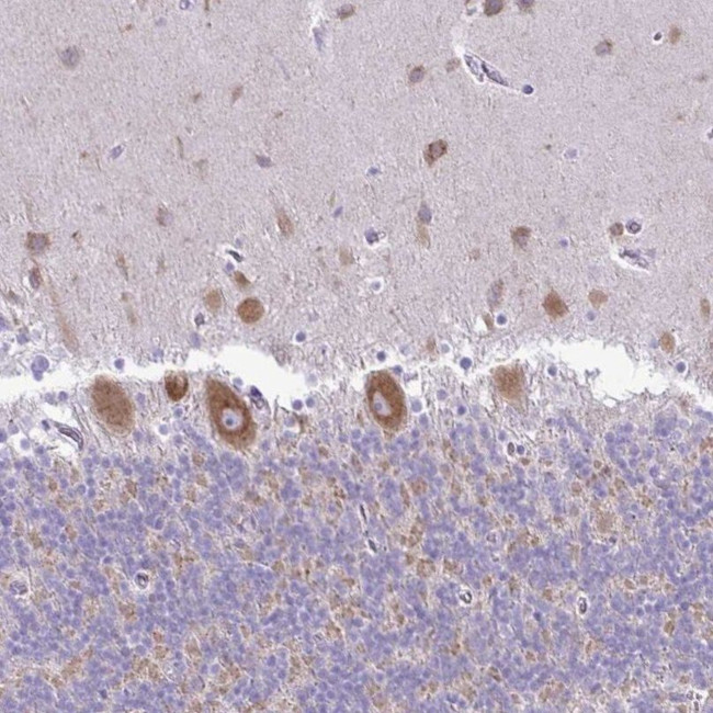Pellino 3 Antibody in Immunohistochemistry (IHC)