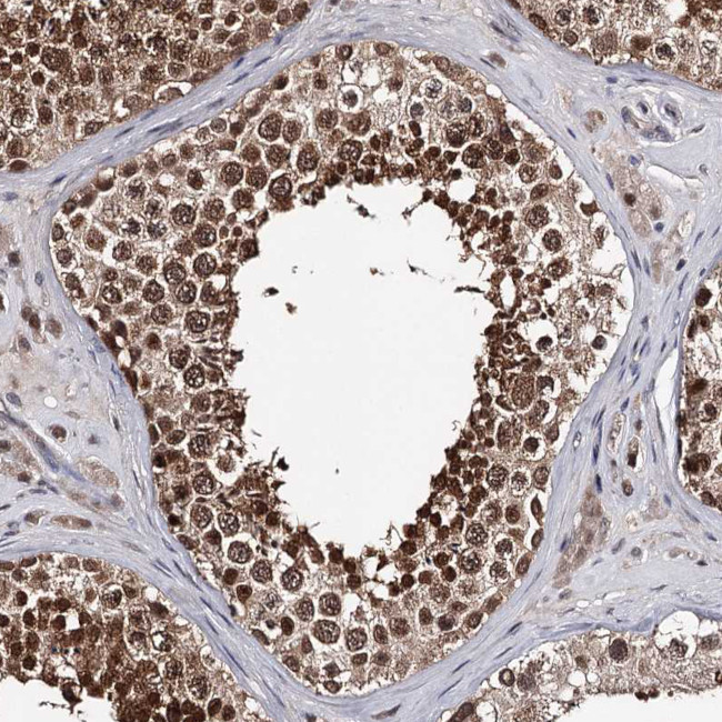 GTSF1 Antibody in Immunohistochemistry (Paraffin) (IHC (P))