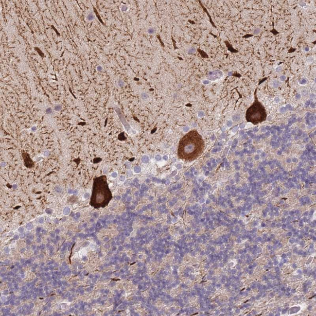 ANKRD10 Antibody in Immunohistochemistry (Paraffin) (IHC (P))