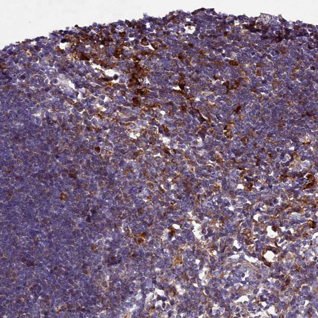HDC Antibody in Immunohistochemistry (IHC)