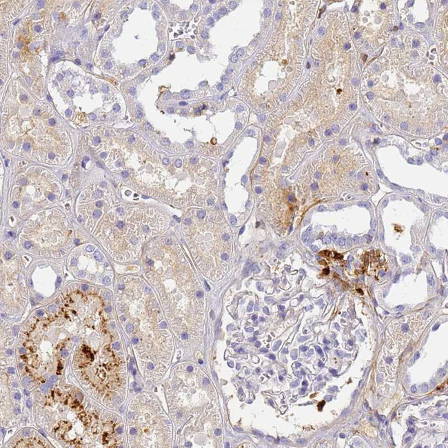 CFHR1 Antibody in Immunohistochemistry (Paraffin) (IHC (P))