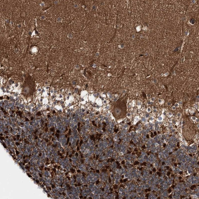 C11orf80 Antibody in Immunohistochemistry (Paraffin) (IHC (P))