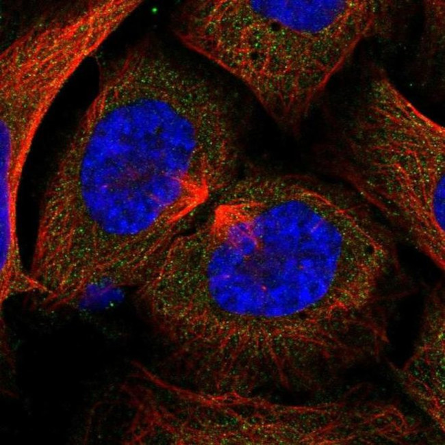 hCG beta Antibody in Immunocytochemistry (ICC/IF)