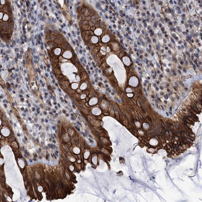 ABLIM1 Antibody in Immunohistochemistry (Paraffin) (IHC (P))