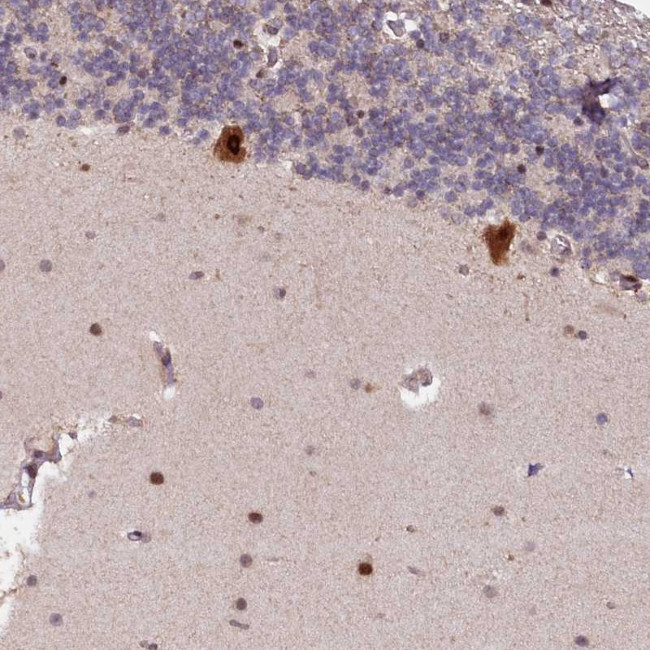 N4BP2L1 Antibody in Immunohistochemistry (Paraffin) (IHC (P))