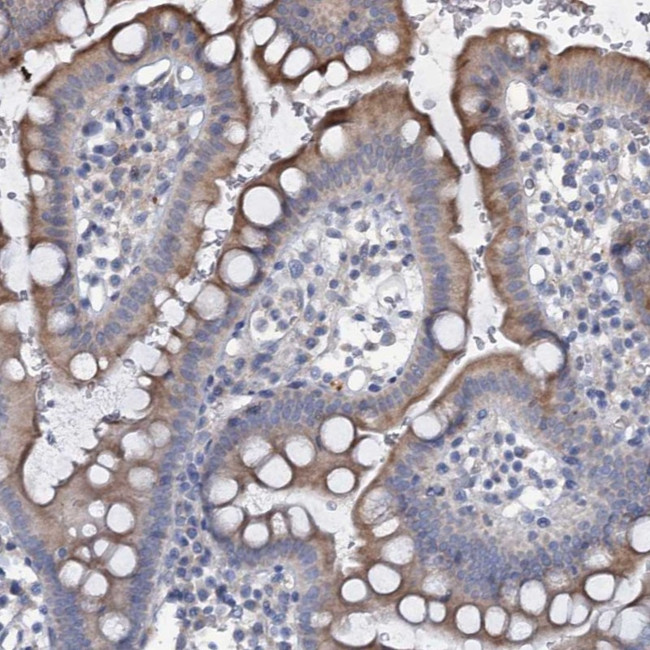 URAD Antibody in Immunohistochemistry (Paraffin) (IHC (P))