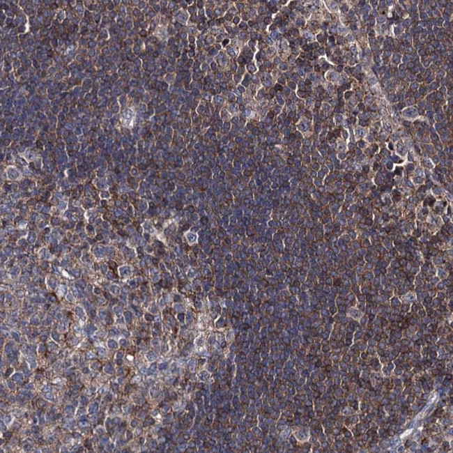 DEF6 Antibody in Immunohistochemistry (Paraffin) (IHC (P))