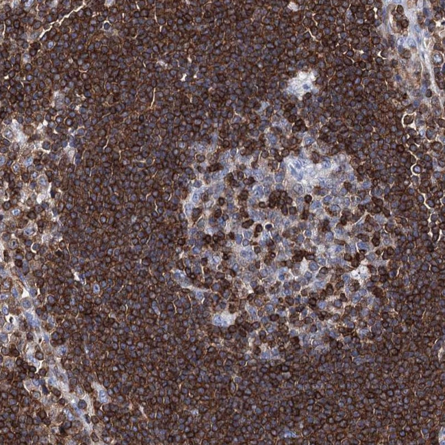 DEF6 Antibody in Immunohistochemistry (Paraffin) (IHC (P))