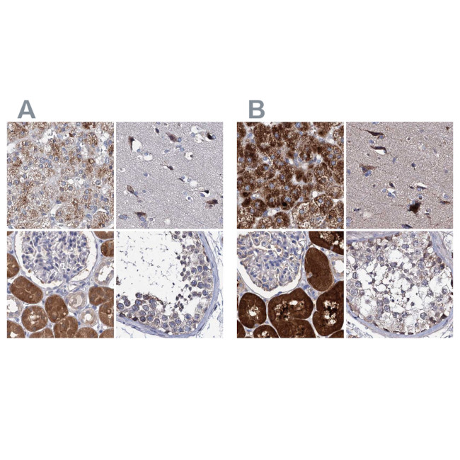 CLPB Antibody in Immunohistochemistry (IHC)