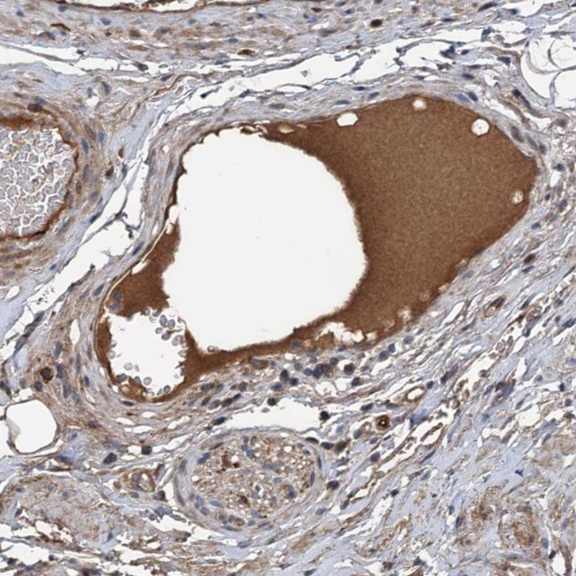 C14orf80 Antibody in Immunohistochemistry (Paraffin) (IHC (P))