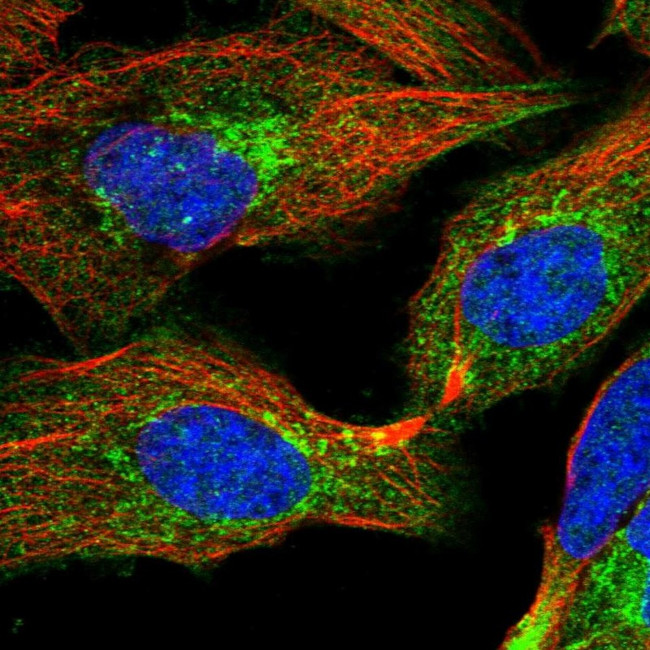 C14orf80 Antibody in Immunocytochemistry (ICC/IF)