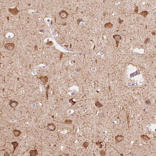 MAP1A Antibody in Immunohistochemistry (Paraffin) (IHC (P))