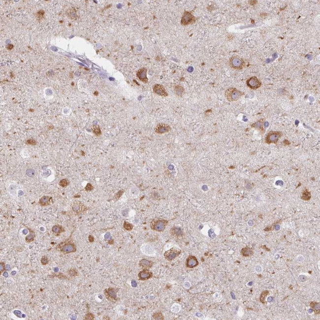 MAP1A Antibody in Immunohistochemistry (Paraffin) (IHC (P))