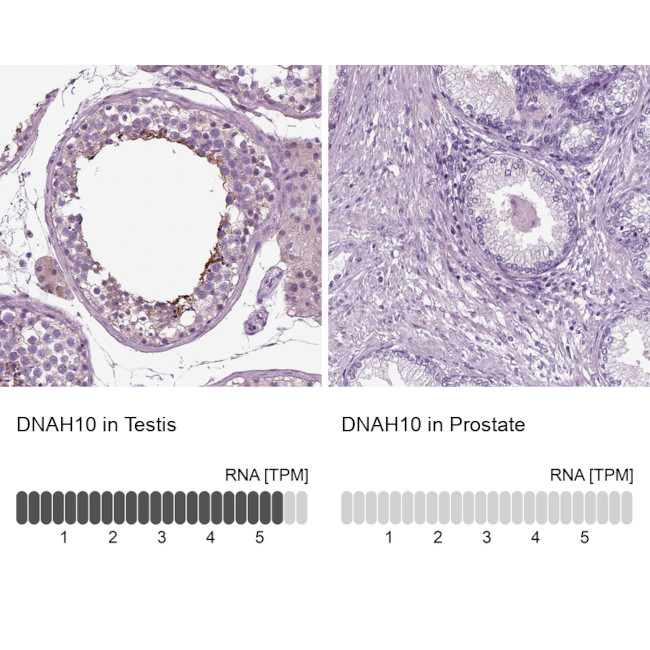 DNAH10 Antibody in Immunohistochemistry (IHC)