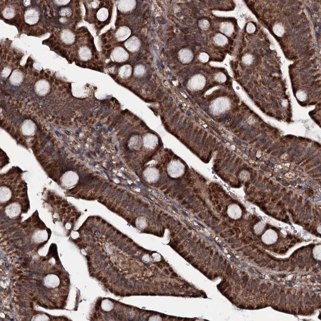 MRPS31 Antibody in Immunohistochemistry (Paraffin) (IHC (P))