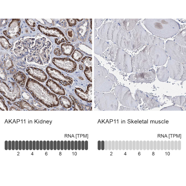 AKAP11 Antibody in Immunohistochemistry (IHC)