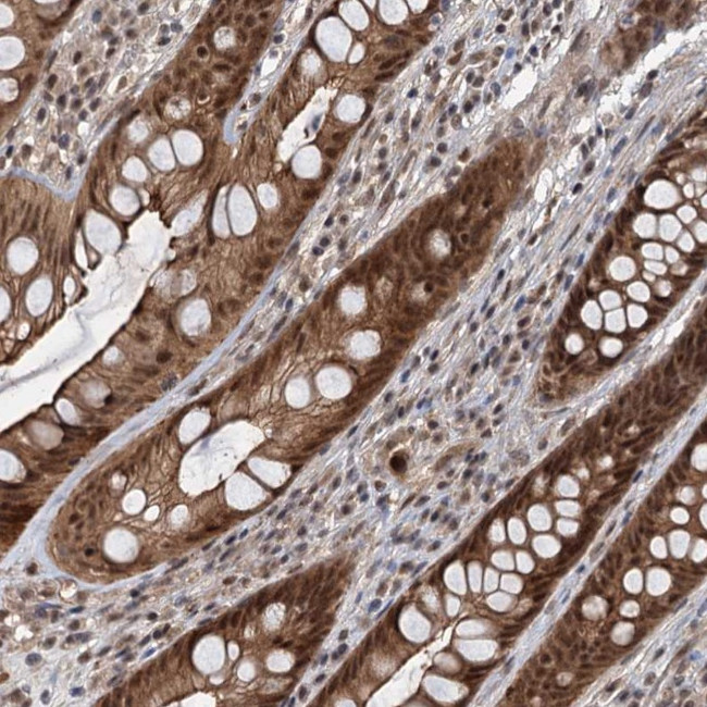 RITA1 Antibody in Immunohistochemistry (Paraffin) (IHC (P))