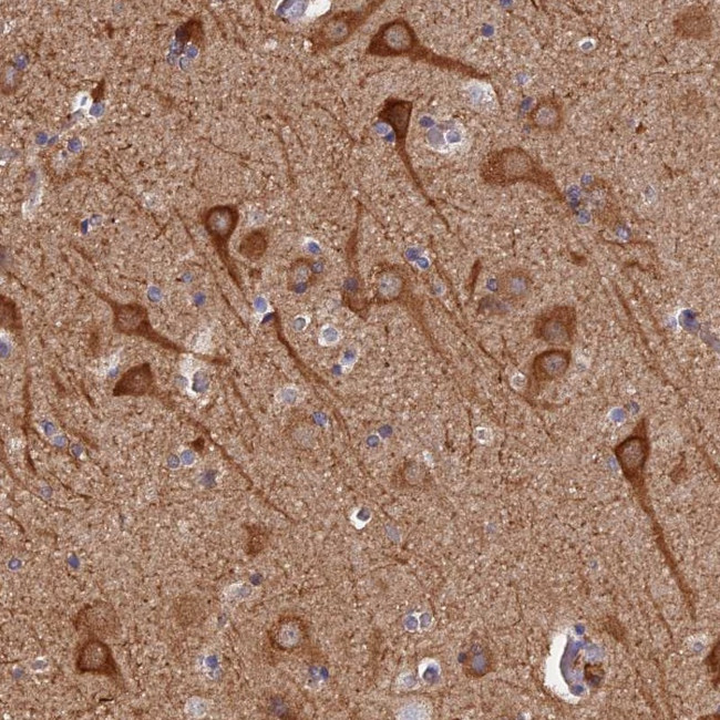 PIGQ Antibody in Immunohistochemistry (Paraffin) (IHC (P))