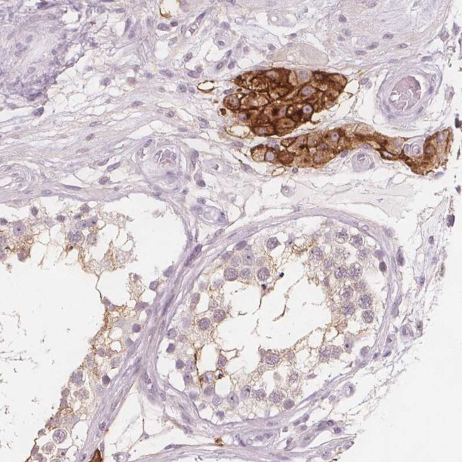 C1orf167 Antibody in Immunohistochemistry (Paraffin) (IHC (P))