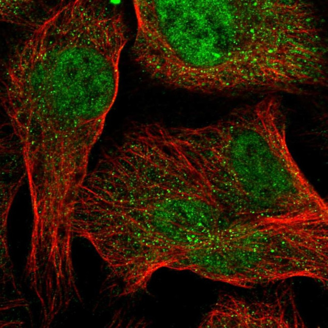 TMEM39A Antibody in Immunocytochemistry (ICC/IF)