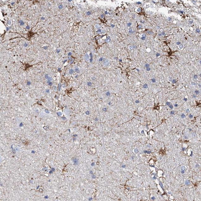 KLHL32 Antibody in Immunohistochemistry (Paraffin) (IHC (P))