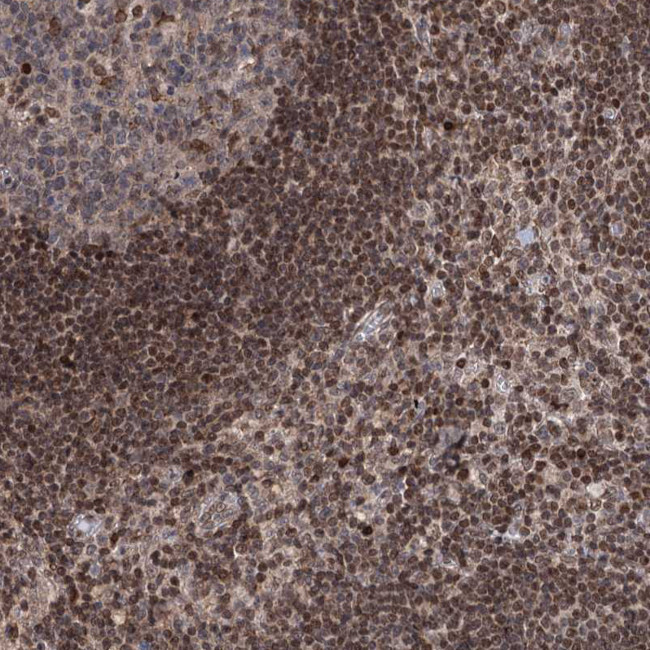 PHC3 Antibody in Immunohistochemistry (Paraffin) (IHC (P))