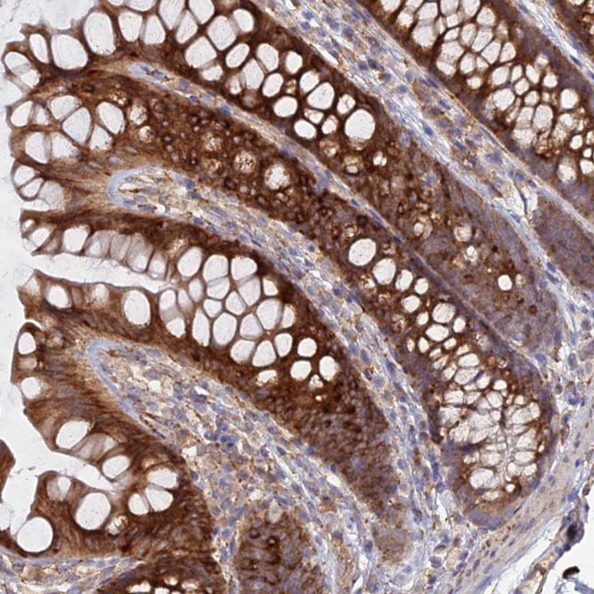 Cyclophilin C Antibody in Immunohistochemistry (Paraffin) (IHC (P))