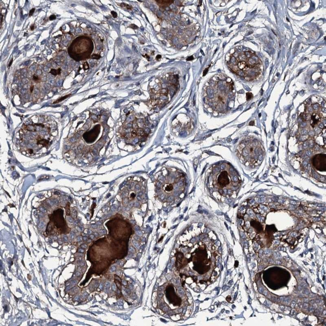 LYG2 Antibody in Immunohistochemistry (Paraffin) (IHC (P))