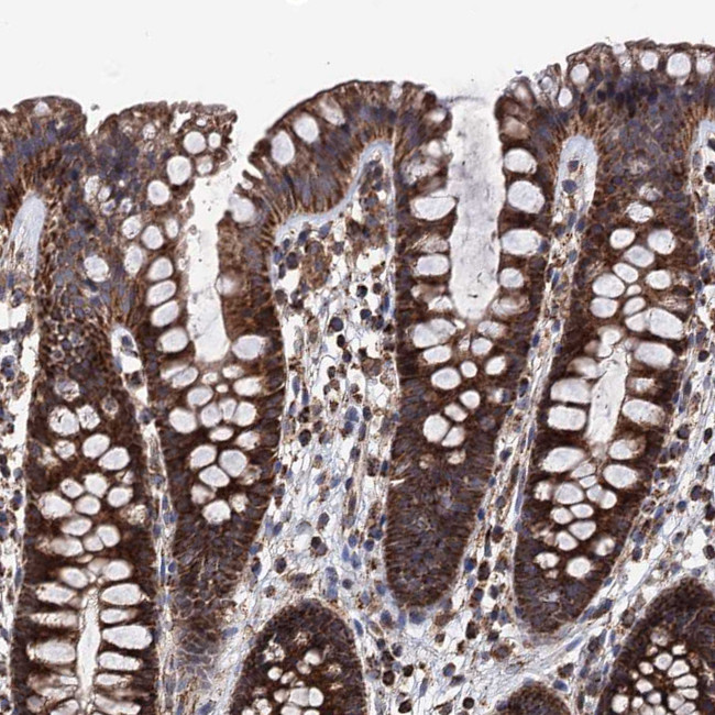 FGFBP2 Antibody in Immunohistochemistry (Paraffin) (IHC (P))