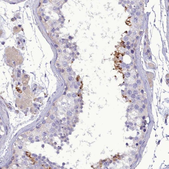 FAM149B1 Antibody in Immunohistochemistry (IHC)