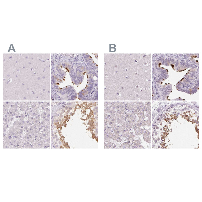 ROPN1L Antibody in Immunohistochemistry (IHC)