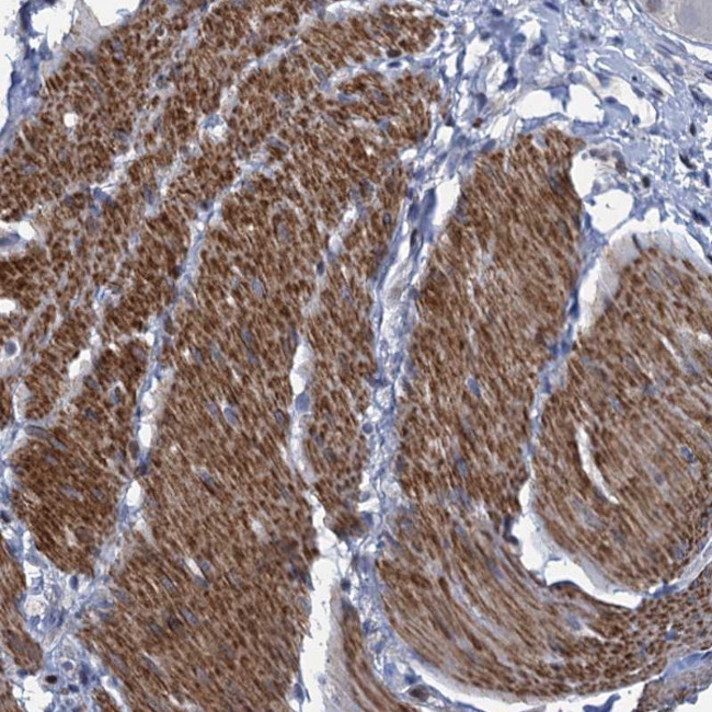 FAM62C Antibody in Immunohistochemistry (Paraffin) (IHC (P))