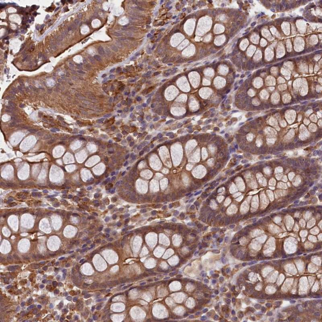 SKIDA1 Antibody in Immunohistochemistry (Paraffin) (IHC (P))