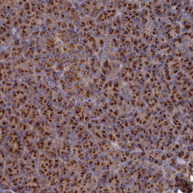 PRRC1 Antibody in Immunohistochemistry (Paraffin) (IHC (P))