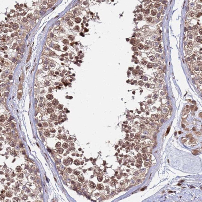 RBMS2 Antibody in Immunohistochemistry (IHC)