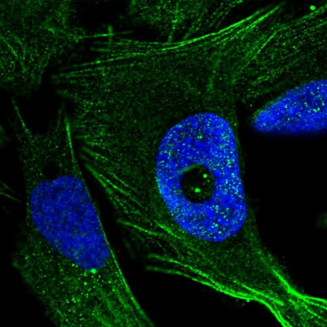 FGD4 Antibody in Immunocytochemistry (ICC/IF)