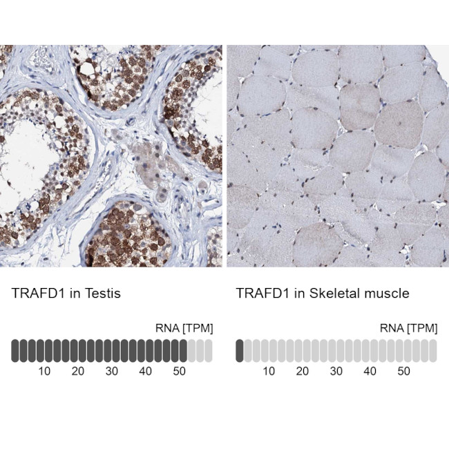 TRAFD1 Antibody in Immunohistochemistry (IHC)