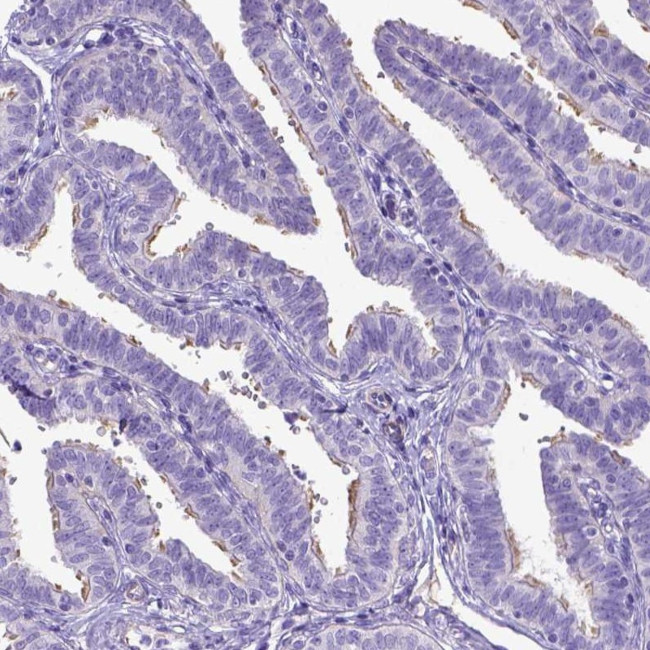 LRRC18 Antibody in Immunohistochemistry (Paraffin) (IHC (P))