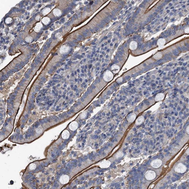IFITM5 Antibody in Immunohistochemistry (Paraffin) (IHC (P))