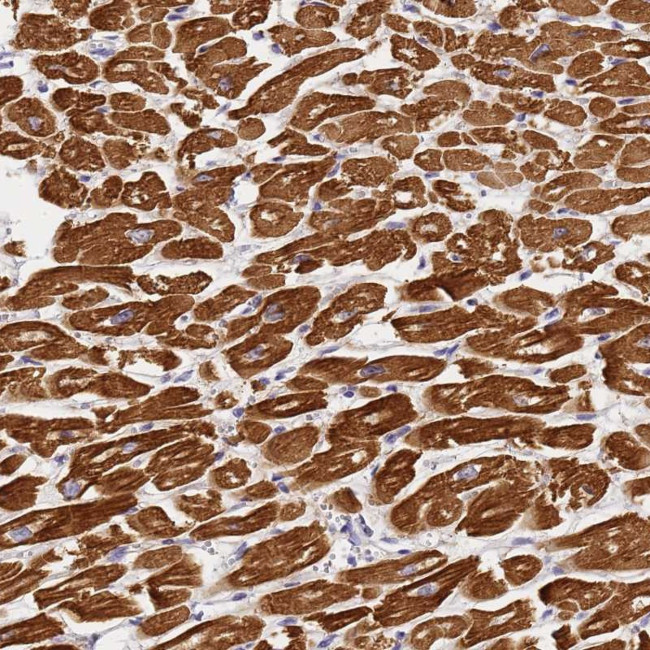 MYL2 Antibody in Immunohistochemistry (Paraffin) (IHC (P))