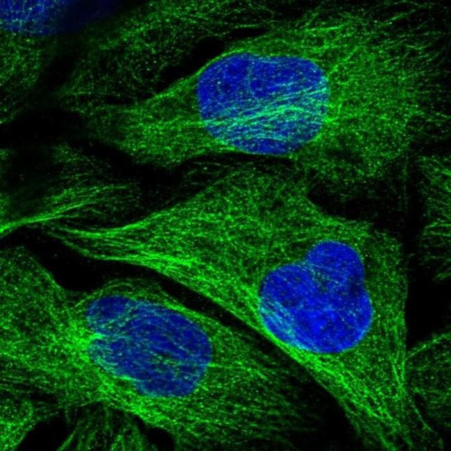 KIF18A Antibody in Immunocytochemistry (ICC/IF)