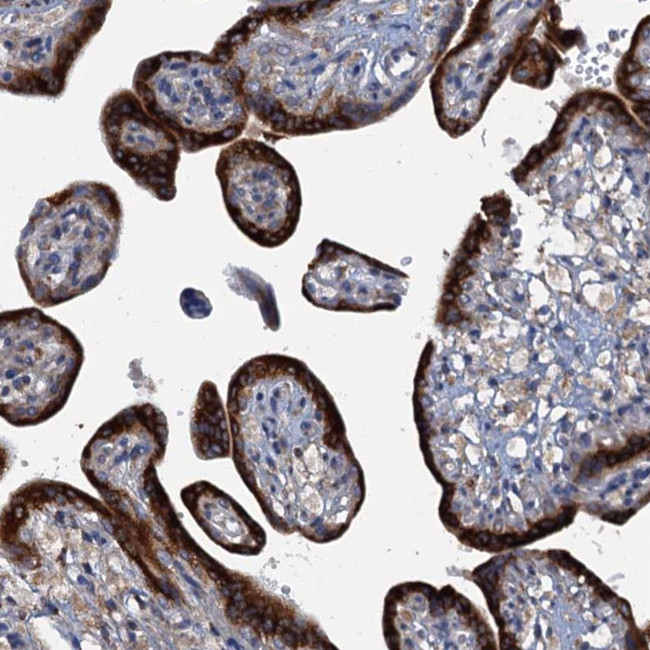 KDELC2 Antibody in Immunohistochemistry (Paraffin) (IHC (P))