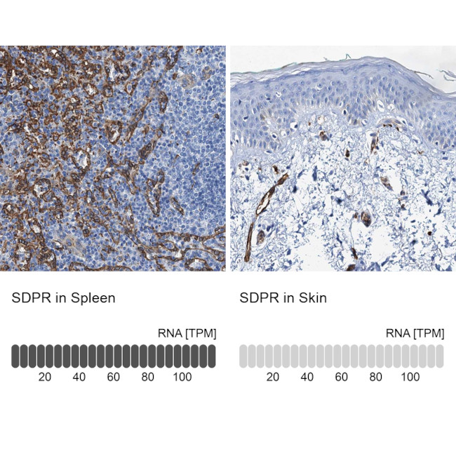 SDPR Antibody in Immunohistochemistry (IHC)